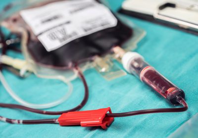 A medula óssea é utilizada no tratamento de cânceres no sangue e em outras doenças não malignas