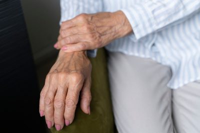 Quando a osteoporose é diagnosticada, o tratamento depende das necessidades de cada paciente